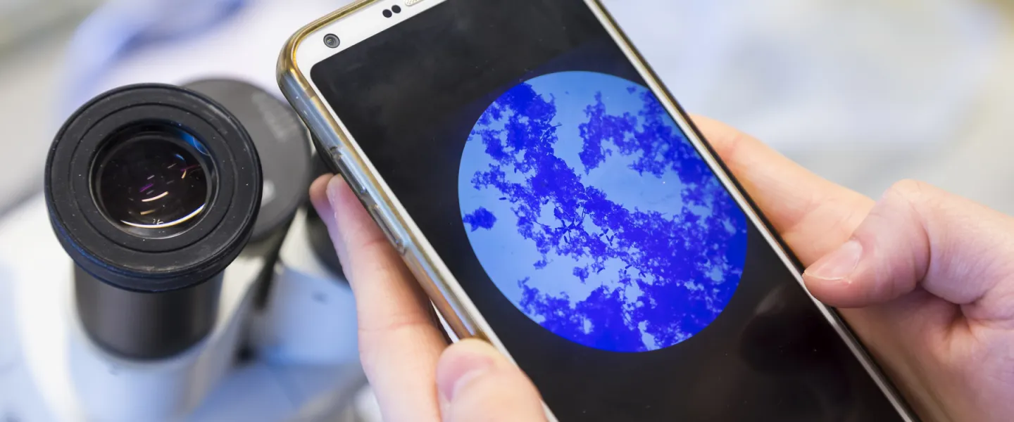 Phone screen showing picture from a microscope