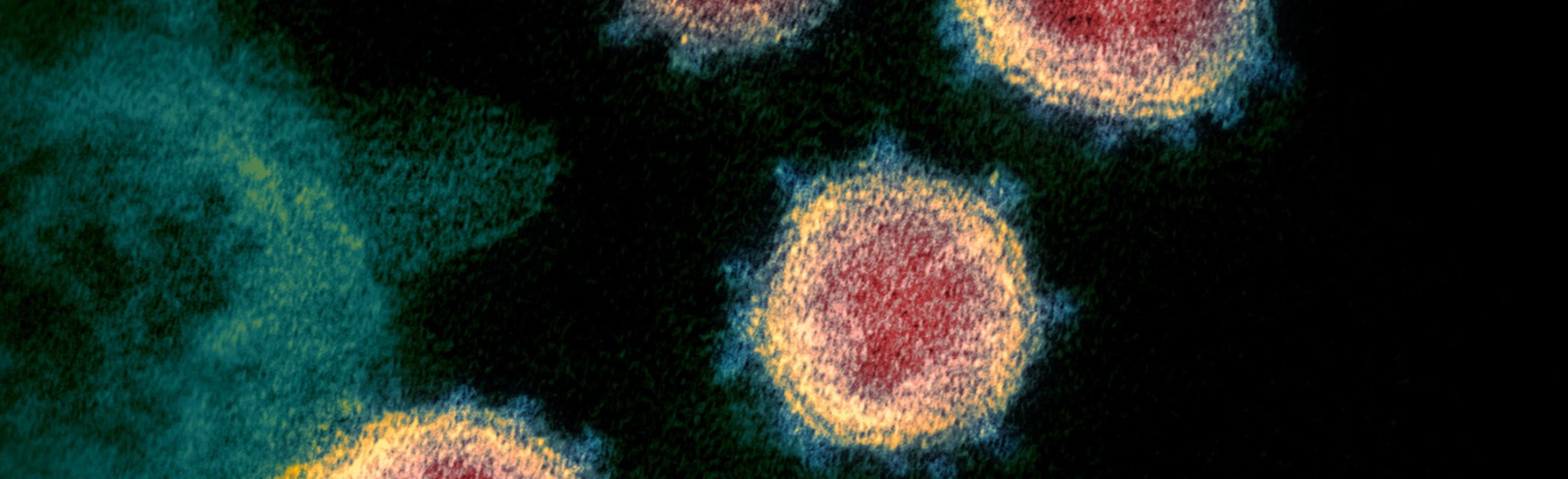 Changes to virus transmission in humans - Available at University of Iceland