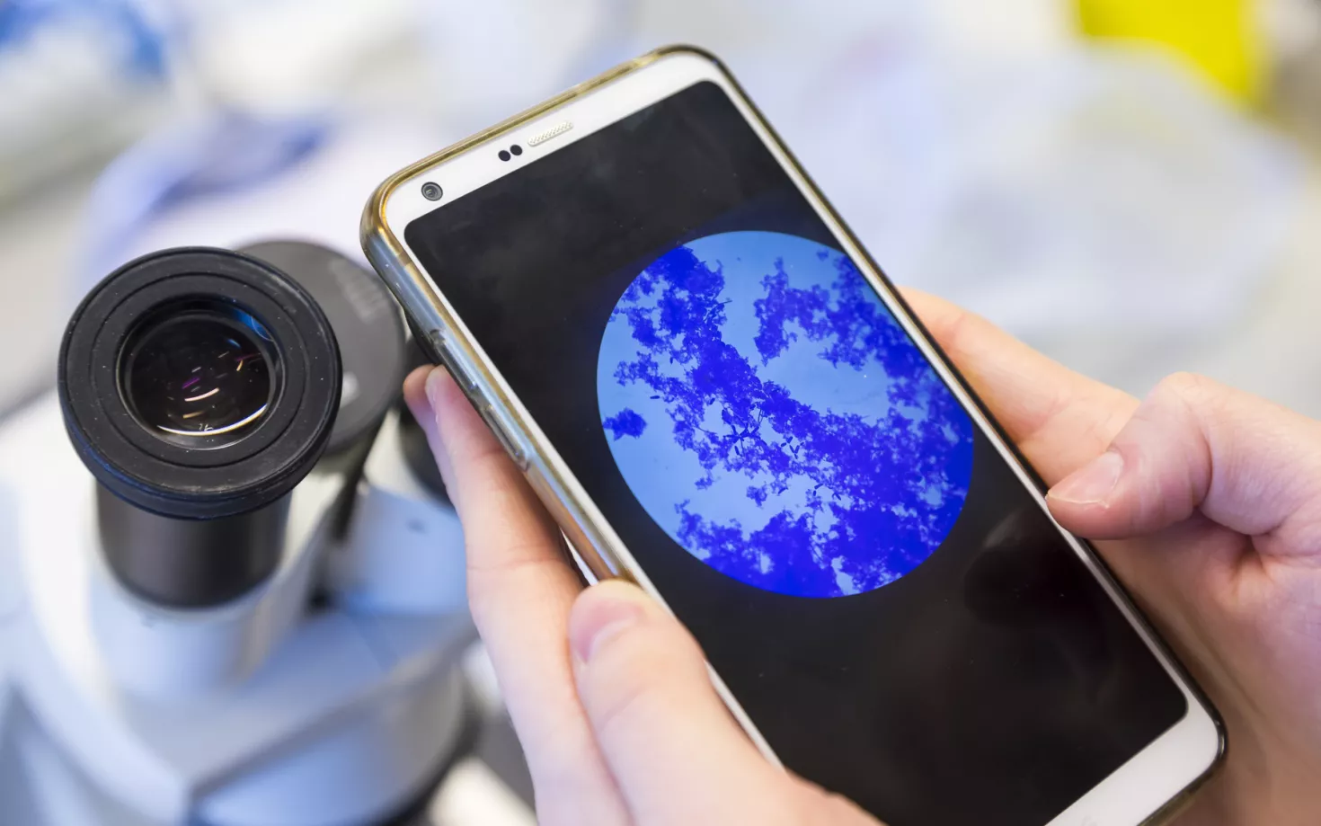 Phone screen showing picture from a microscope