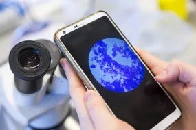 Phone screen showing picture from a microscope