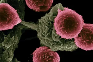 Photo by <a href="https://unsplash.com/@nci?utm_source=unsplash&utm_medium=referral&utm_content=creditCopyText">National Cancer Institute</a> on <a href="https://unsplash.com/photos/pink-cells-on-green-structure-LnvCEXQwC-o?utm_source=unsplash&utm_medium=referral&utm_content=creditCopyText">Unsplash</a>
